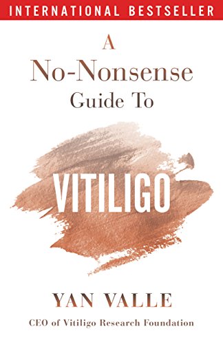 A No-Nonsense Guide To Vitiligo by Yan Valle now available - The Vitiligo  Society